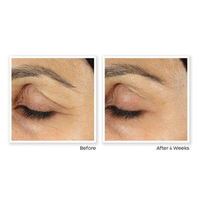 RETINOL CORREXION® Eye Cream - Roc Skincare - Harvey Prince Organics - USA - NY - NJ