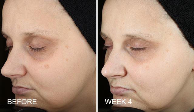 Universal C Skin Refiner Before After 100% Result – Beautystat – Harvey Prince Organics-1