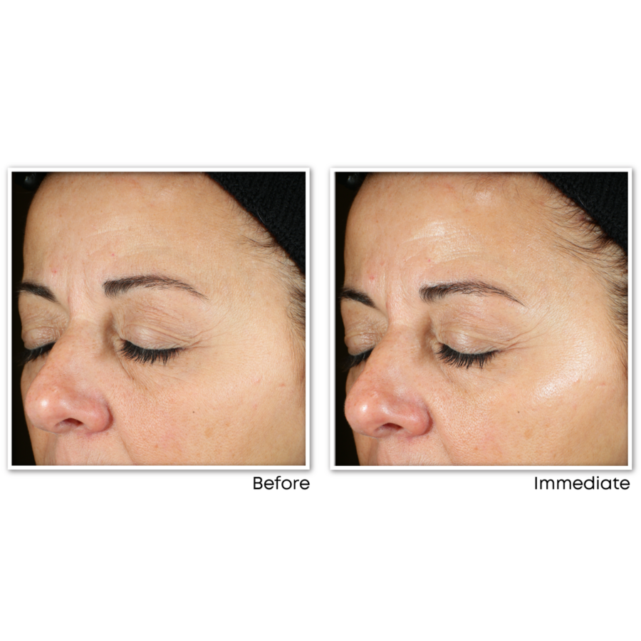 MULTI CORREXION® Revive + Glow Daily Serum - Image 3