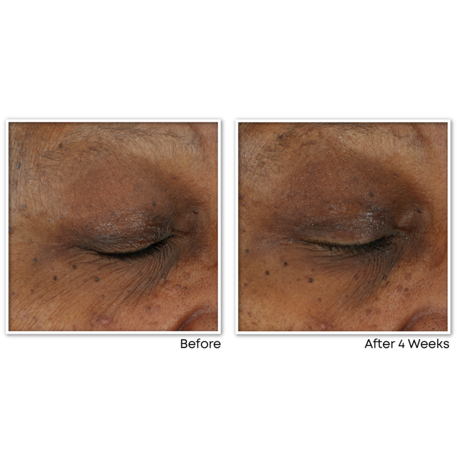 MULTI CORREXION® Revive + Glow Daily Serum - Image 4