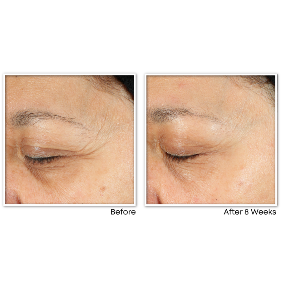 MULTI CORREXION® Revive + Glow Daily Serum - Image 5