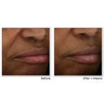 MULTI CORREXION® Revive + Glow Gel Cream - Image 3