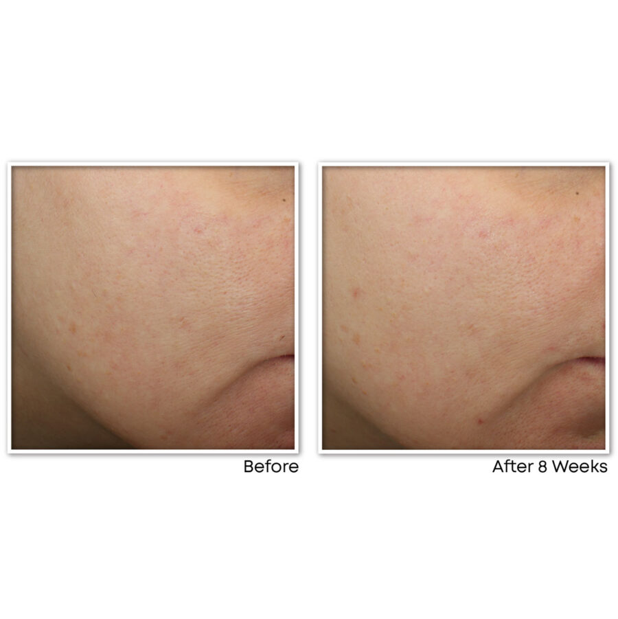 MULTI CORREXION® Revive + Glow Gel Cream - Image 5