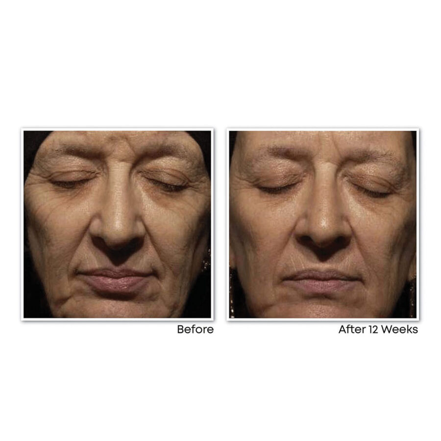 RETINOL CORREXION® Deep Wrinkle Night Cream - Image 3