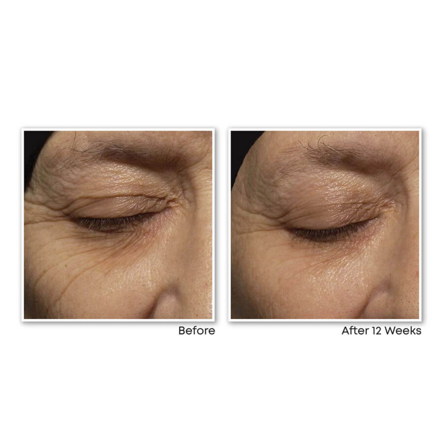 RETINOL CORREXION® Deep Wrinkle Night Cream - Image 4