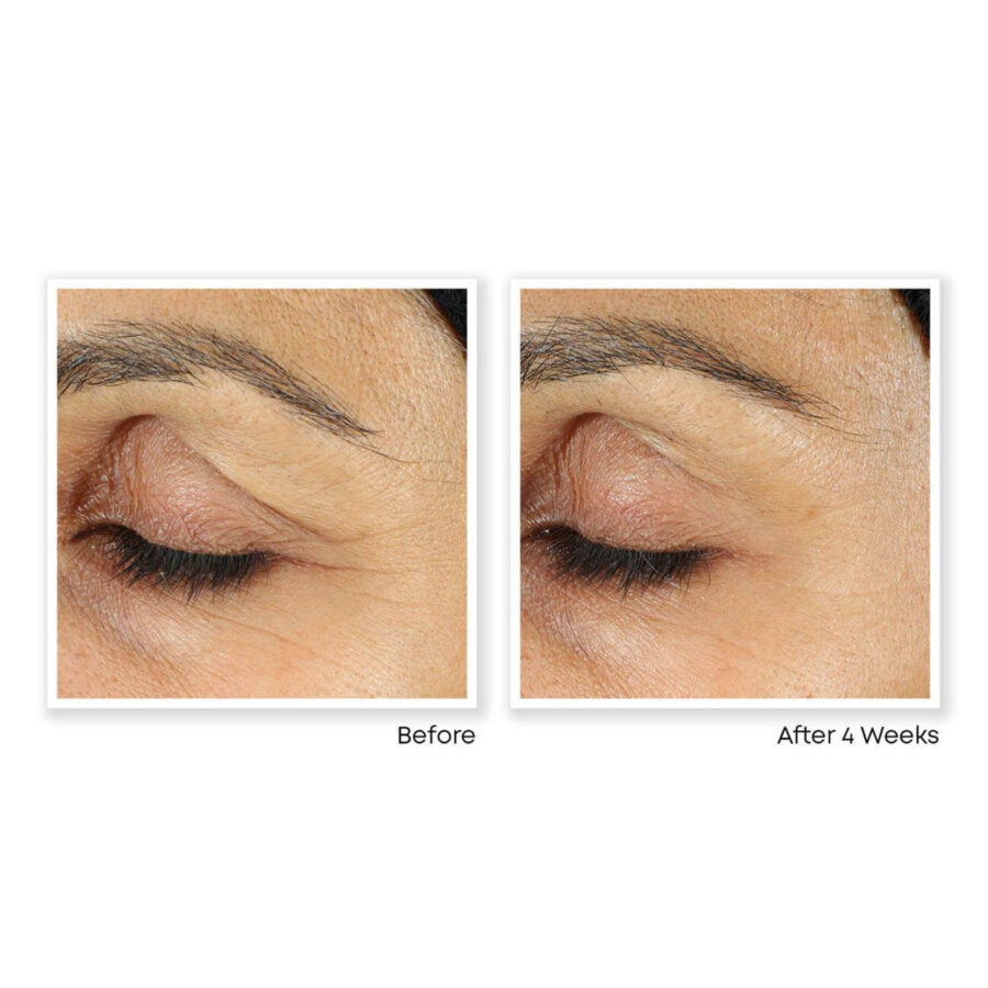 RETINOL CORREXION® Eye Cream - Image 4
