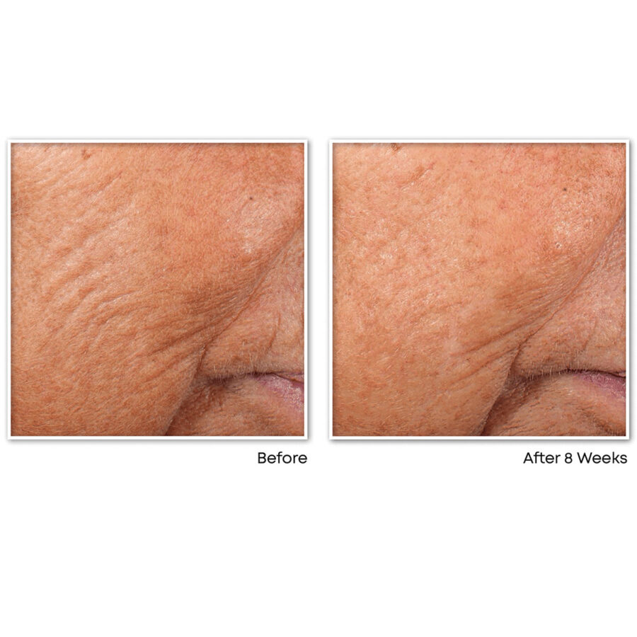 RETINOL CORREXION® Line Smoothing Night Serum Capsules - Image 6