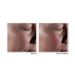 RETINOL CORREXION® MAX Wrinkle Resurfacing System - Image 3