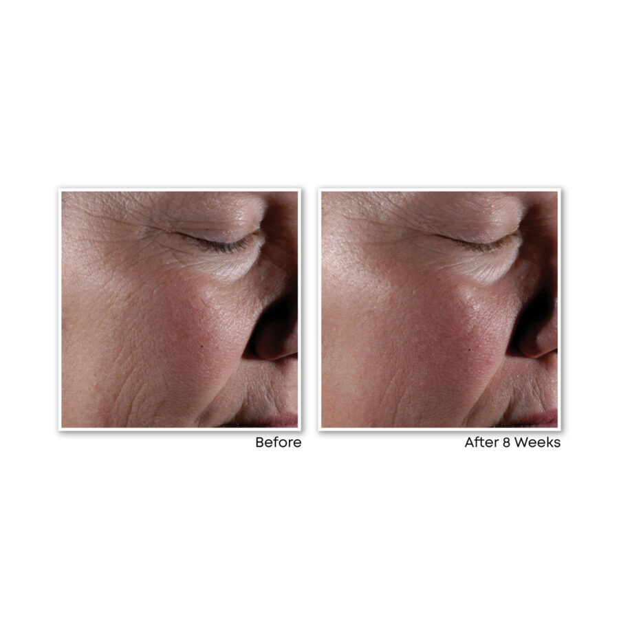 RETINOL CORREXION® MAX Wrinkle Resurfacing System - Image 3